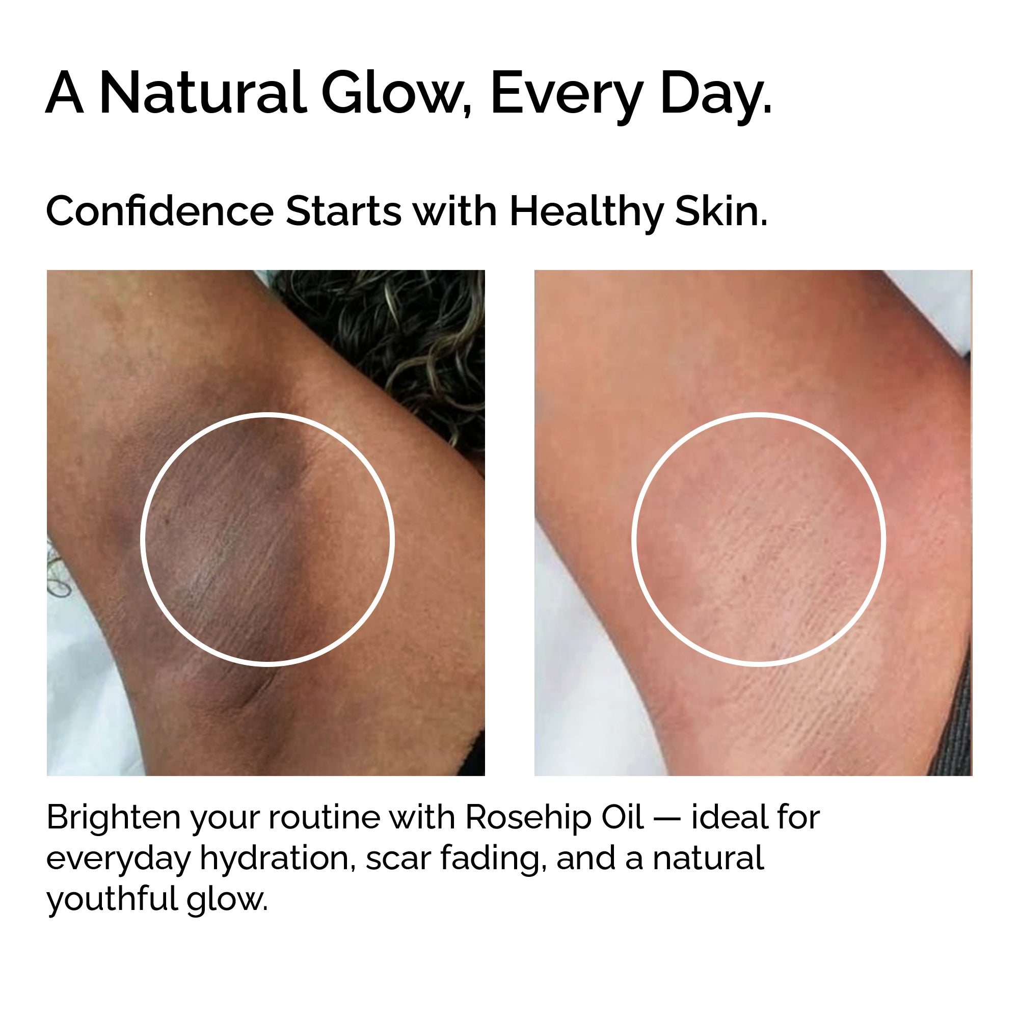 Organic Rosehip Oil – 100% Pure Cold-Pressed Plant-Based Oil for Face, Body & Hair