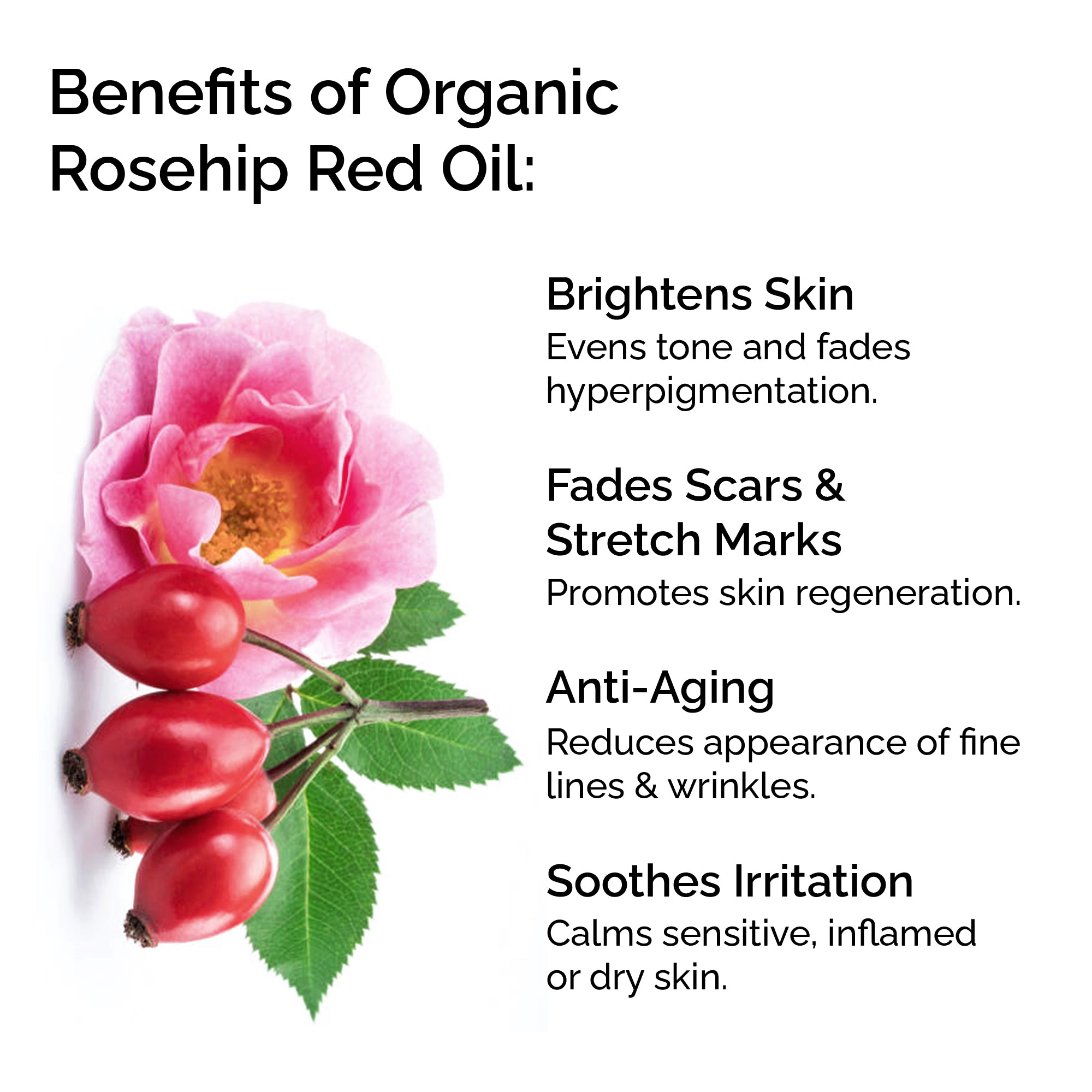 Organic Rosehip Oil – 100% Pure Cold-Pressed Plant-Based Oil for Face, Body & Hair