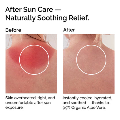 Organic Cooling Aloe Vera Gel – Hydrating &amp; Soothing After-Sun Care