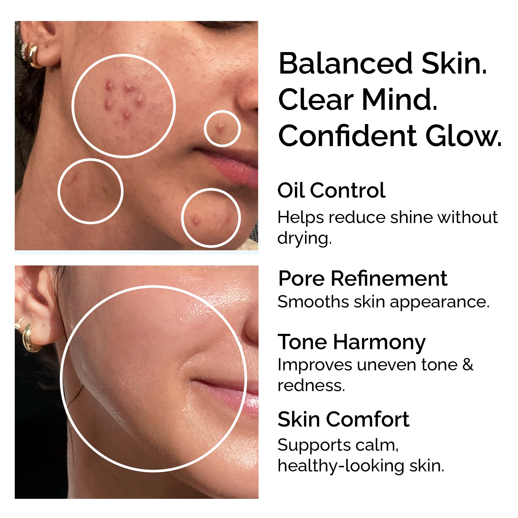 Niacinamide Powder 30g – Pure &amp; Natural Vitamin B3 for Skin Glow, Brightening, Even Skin Tone &amp; Pore Refining Care