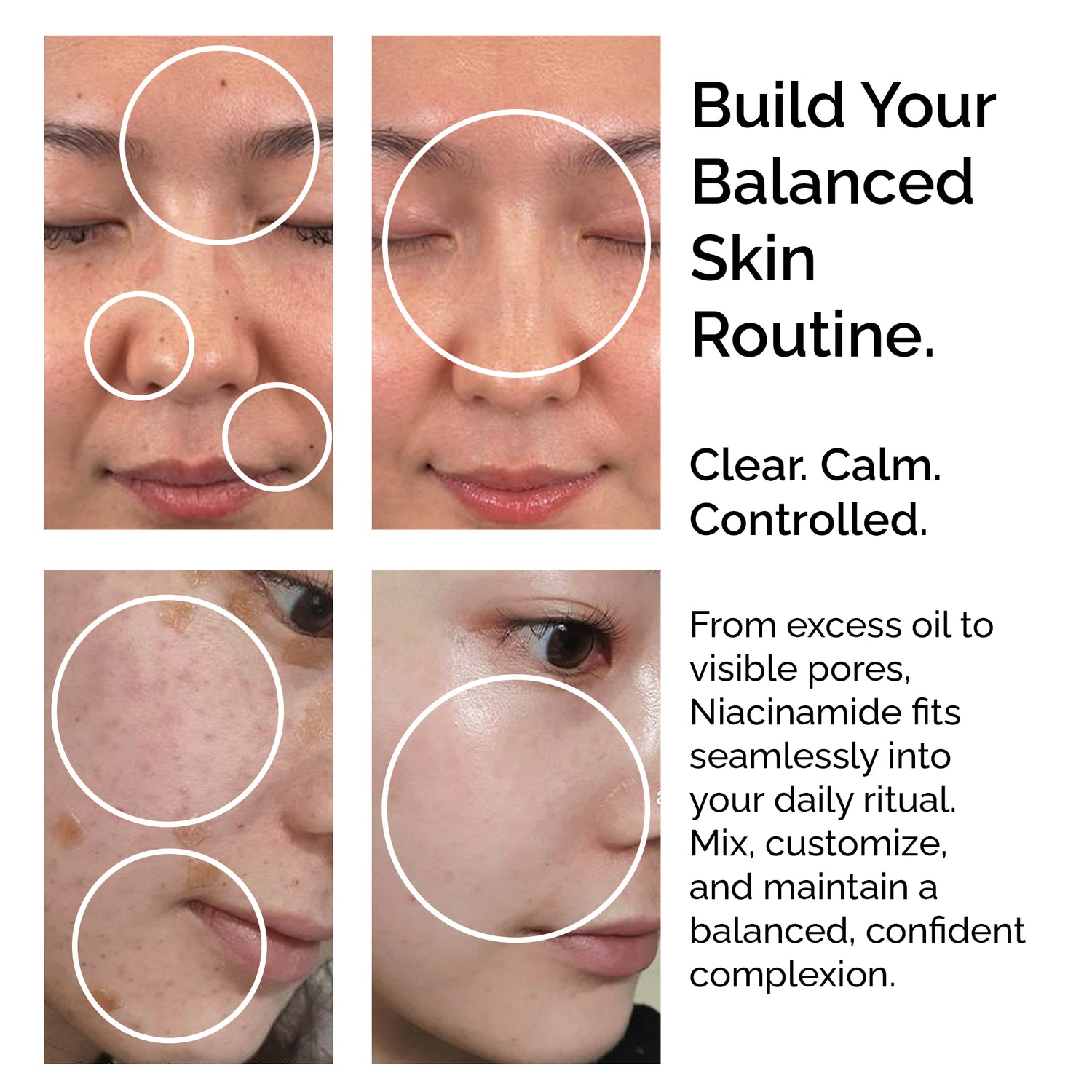 Niacinamide Powder 30g – Pure &amp; Natural Vitamin B3 for Skin Glow, Brightening, Even Skin Tone &amp; Pore Refining Care