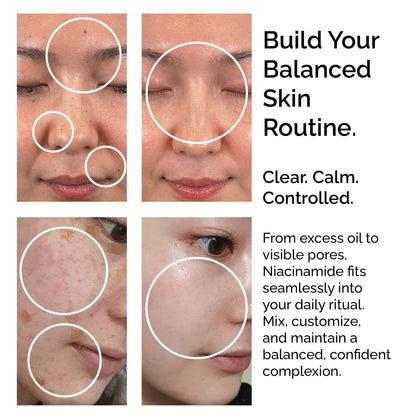 Niacinamide Powder 30g – Pure &amp; Natural Vitamin B3 for Skin Glow, Brightening, Even Skin Tone &amp; Pore Refining Care