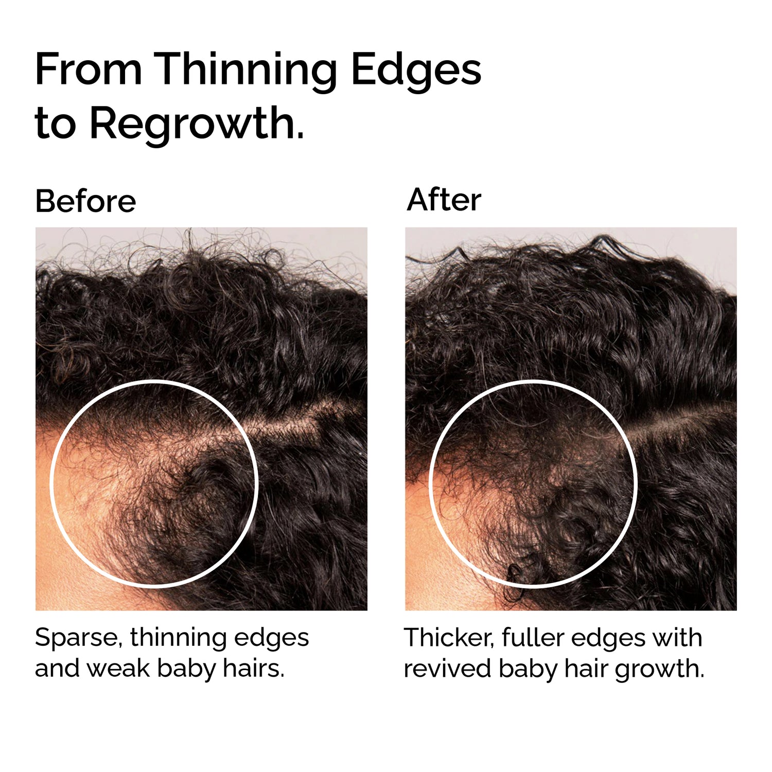 Organic Hair Growth Oil Serum – Strengthening &amp; Nourishing Hair Treatment