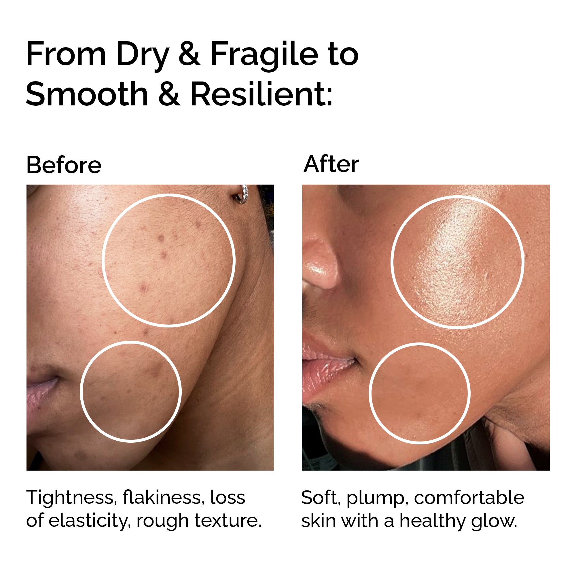 Organic Macadamia Oil – Pure &amp; Cold-Pressed for Face, Body &amp; Hair