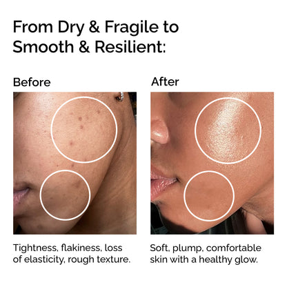 Organic Macadamia Oil – Pure &amp; Cold-Pressed for Face, Body &amp; Hair
