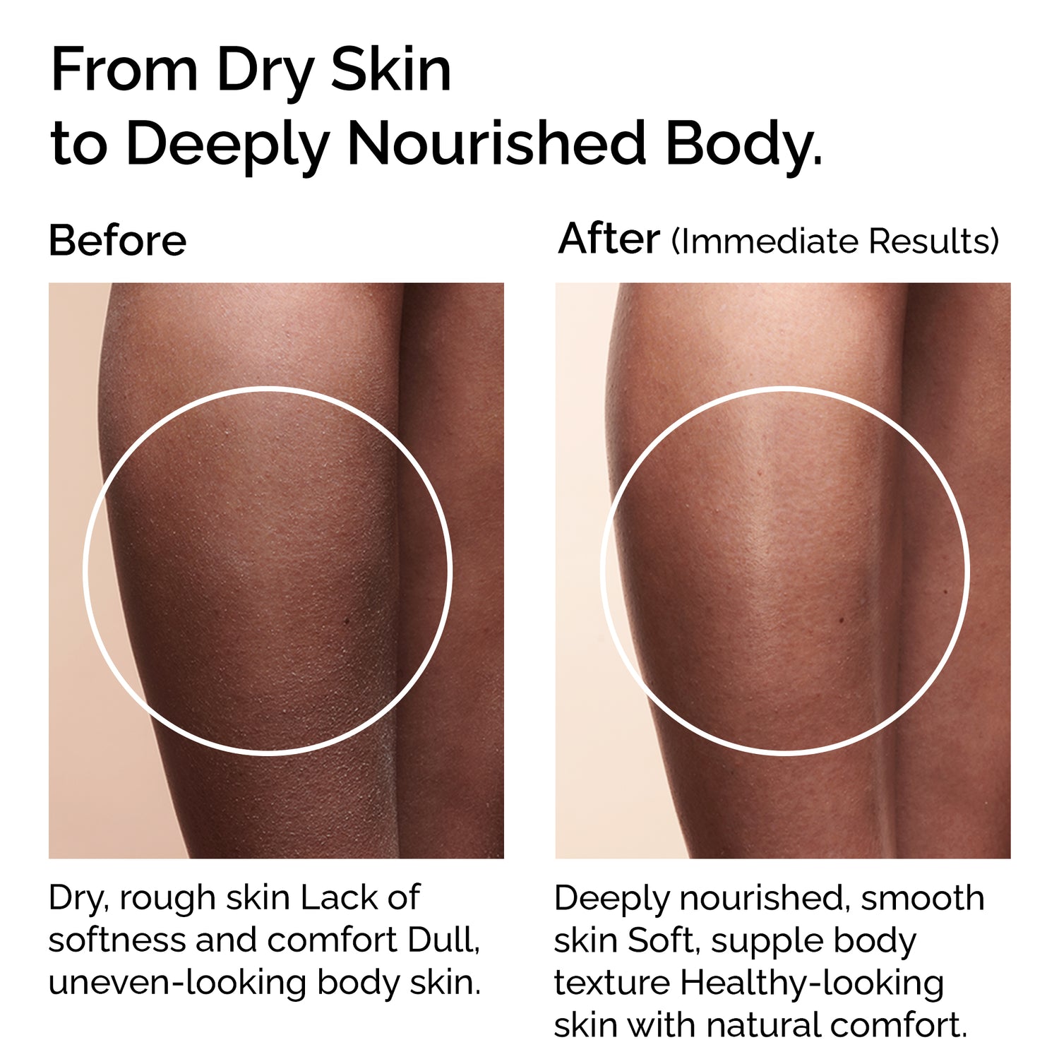 Organic Virgin Coconut Oil. Cold-pressed. Deep moisture for skin, hair &amp; massage