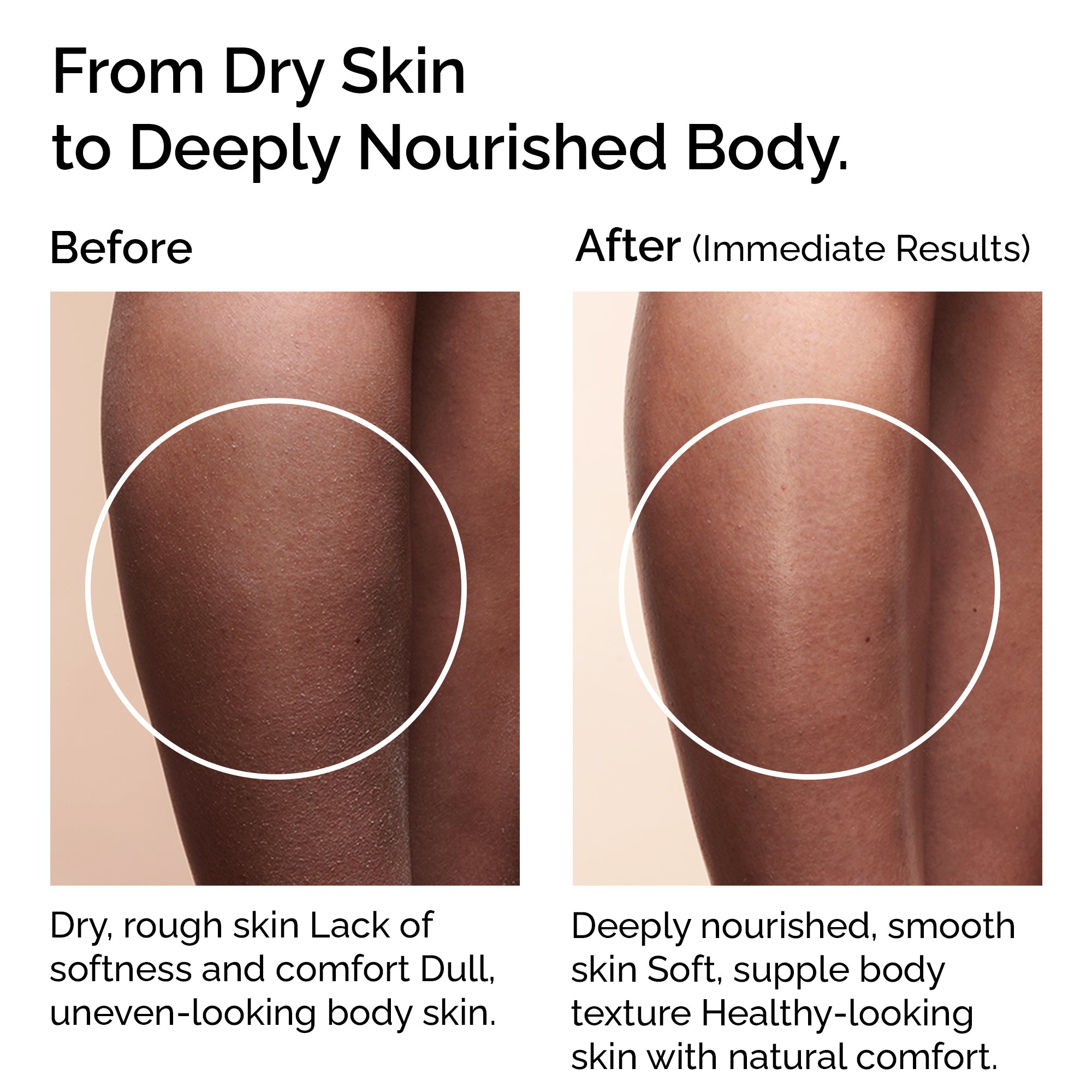 Organic Virgin Coconut Oil. Cold-pressed. Deep moisture for skin, hair &amp; massage