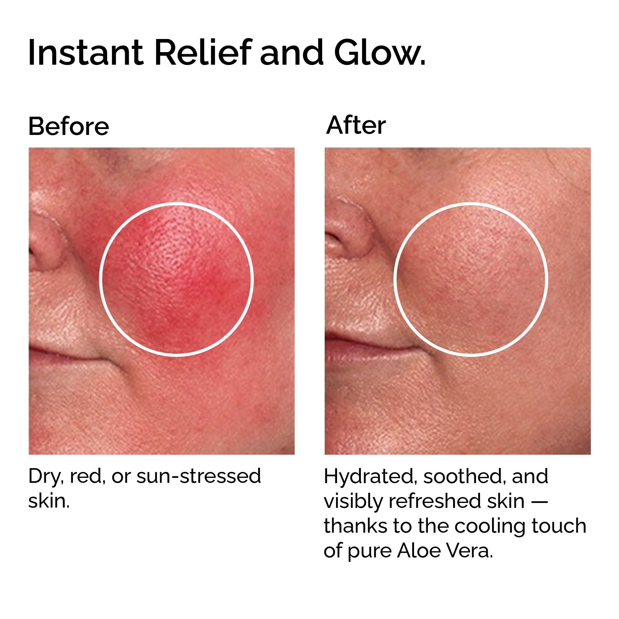 Organic Cooling Aloe Vera Gel – Hydrating &amp; Soothing After-Sun Care