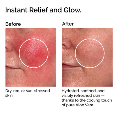 Organic Cooling Aloe Vera Gel – Hydrating &amp; Soothing After-Sun Care