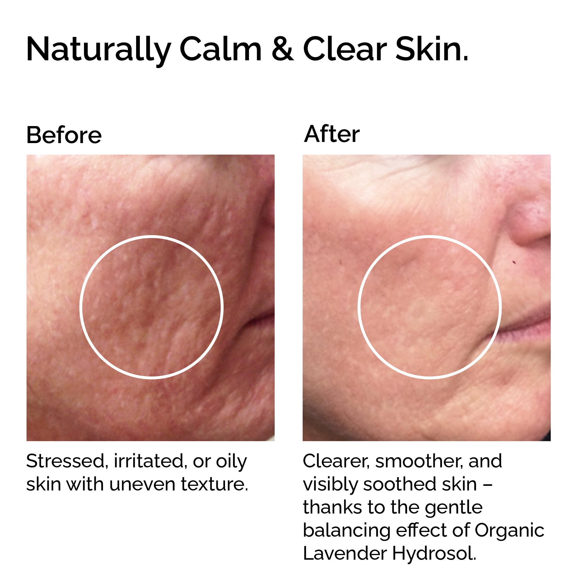 Organic Lavender Hydrosol – Soothing Floral Water for Skin &amp; Hair