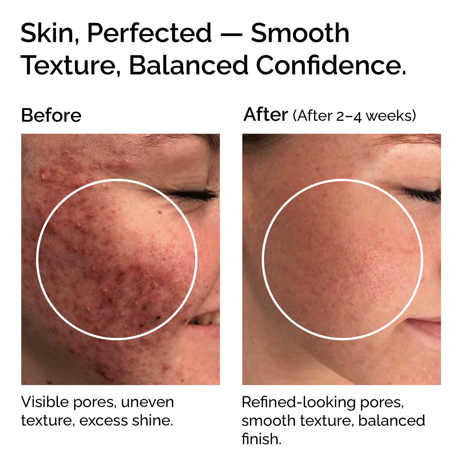 Niacinamide Powder 30g – Pure &amp; Natural Vitamin B3 for Skin Glow, Brightening, Even Skin Tone &amp; Pore Refining Care