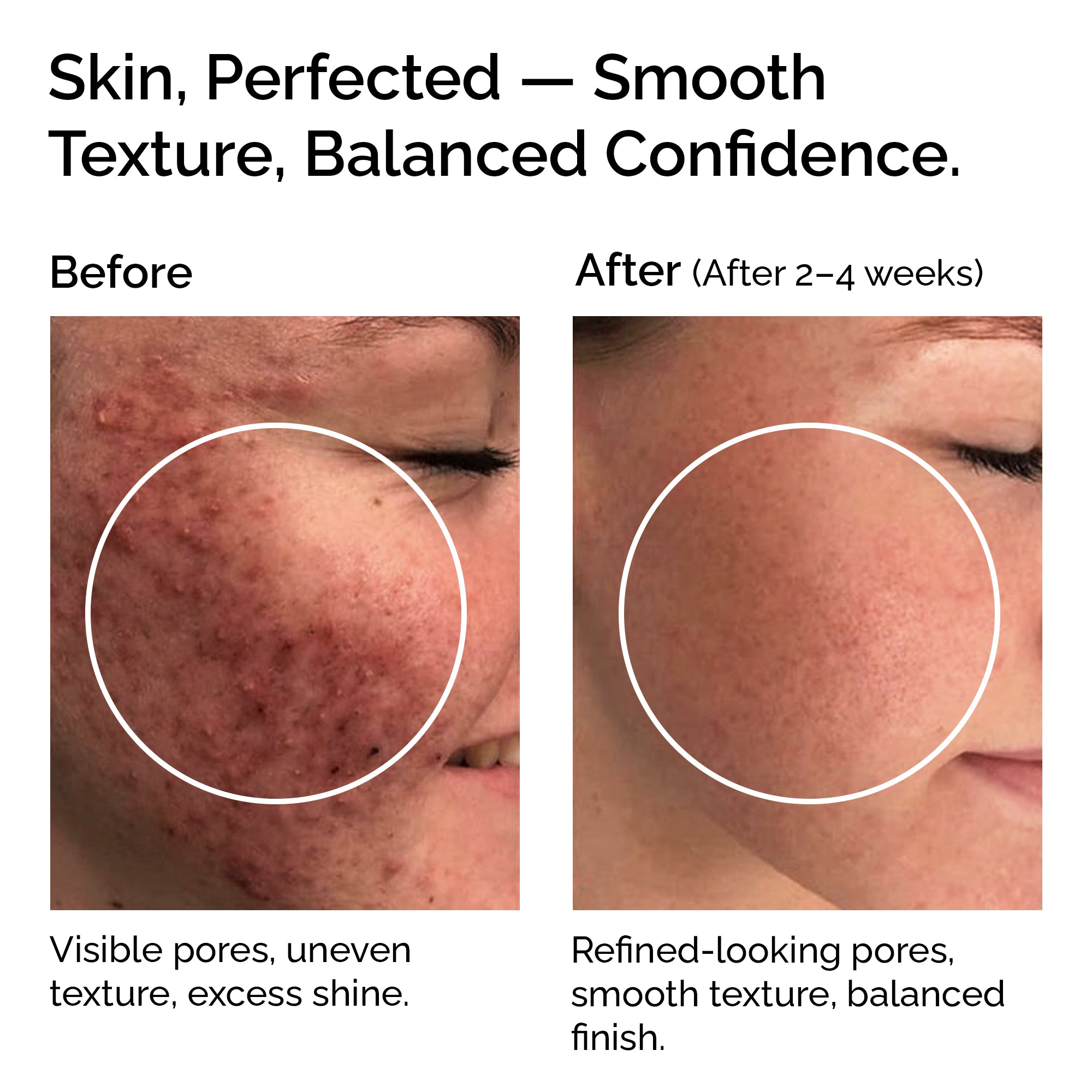 Niacinamide Powder 30g – Pure &amp; Natural Vitamin B3 for Skin Glow, Brightening, Even Skin Tone &amp; Pore Refining Care