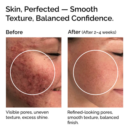 Niacinamide Powder 30g – Pure &amp; Natural Vitamin B3 for Skin Glow, Brightening, Even Skin Tone &amp; Pore Refining Care