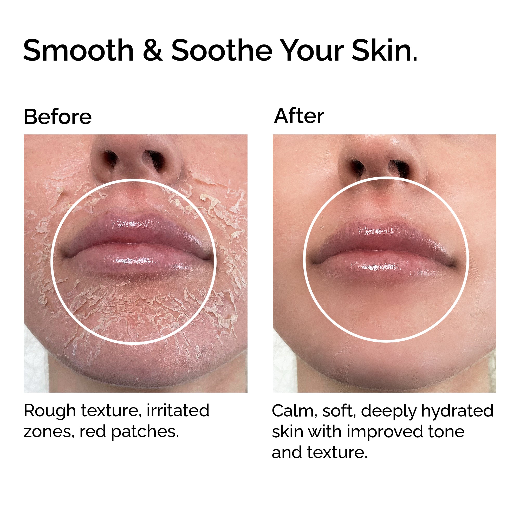 Huile de rose musquée bio – 100 % vierge, pressée à froid et certifiée par la Soil Association | Miracle éclaircissant et anti-âge